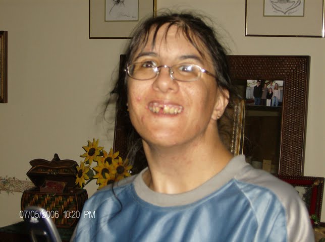 Beautiful retarded girl absolutely Understand this beautiful retarded girl final, sorry